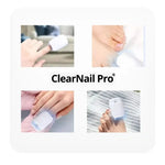 🔥¡Compra 1 y llévate 1 GRATIS! ✨ClearNail Pro® Dispositivo láser para tratamiento de hongos en las uñas